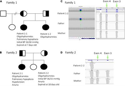 Rapid Trio Exome Sequencing for Autosomal Recessive Renal Tubular Dysgenesis in Recurrent Oligohydramnios